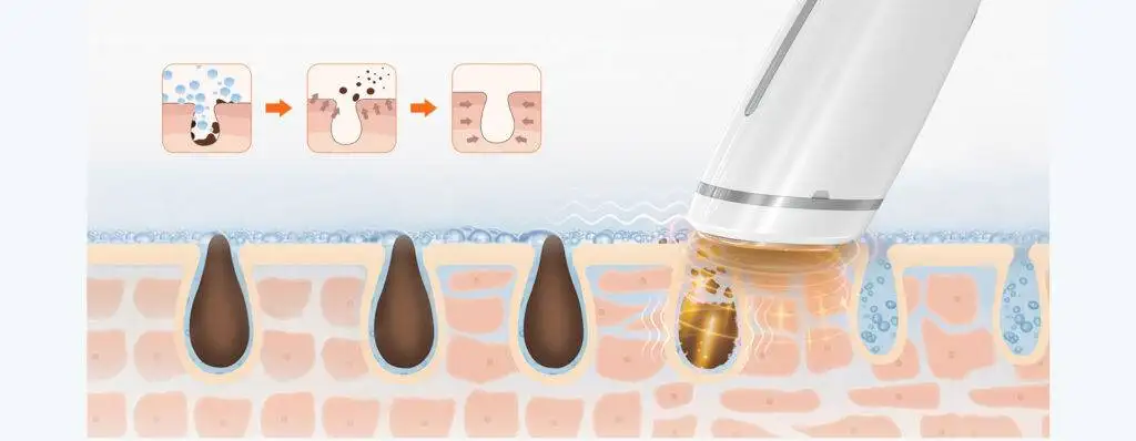 कंपन प्रौद्योगिकी