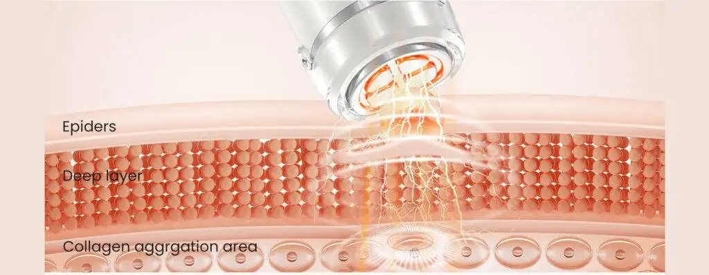 आरएफ प्रौद्योगिकी