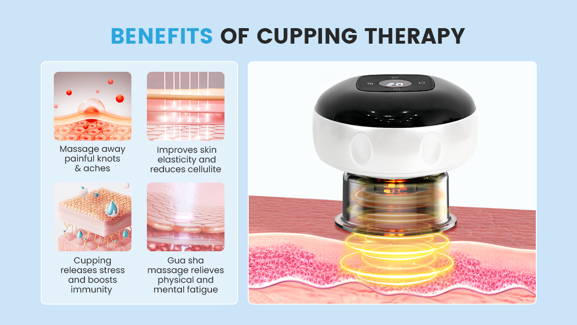 cupping therapy machine supplier