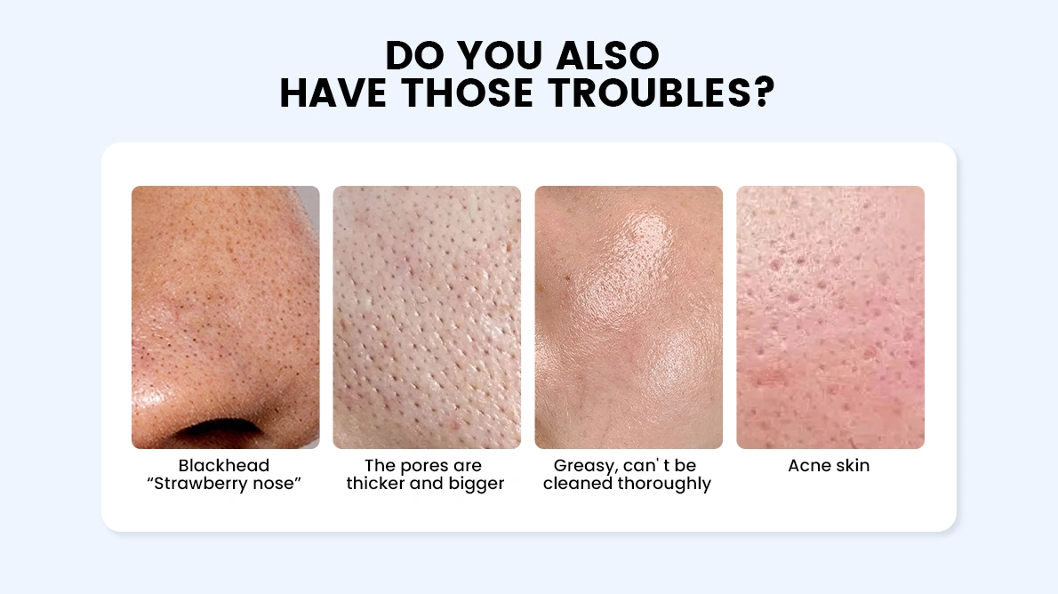 facial beauty problem