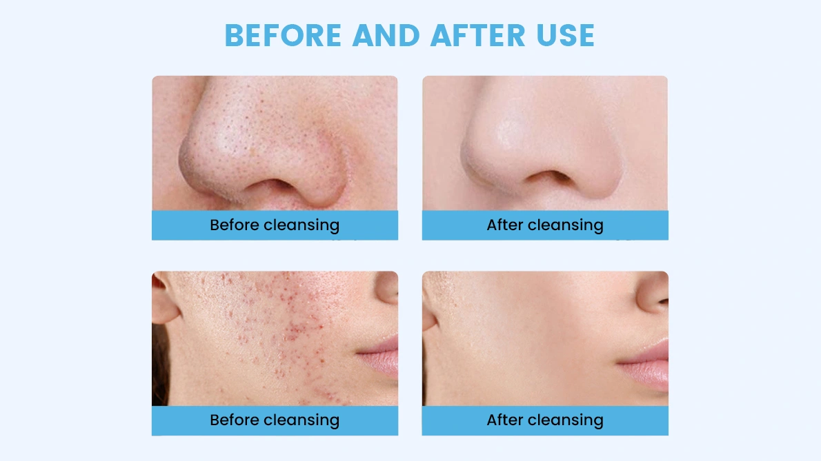 skin scrubber before and after