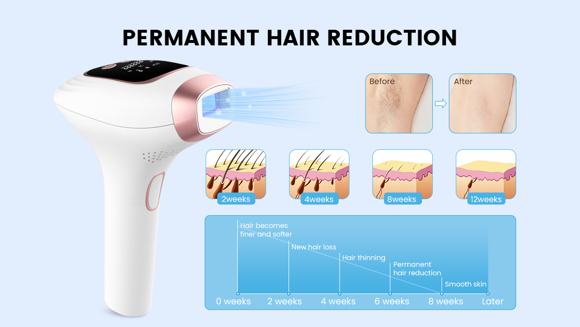 permenant hair removal