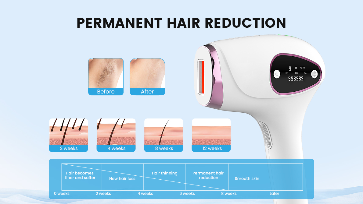 PERMANENT HAIR REDUCTION
