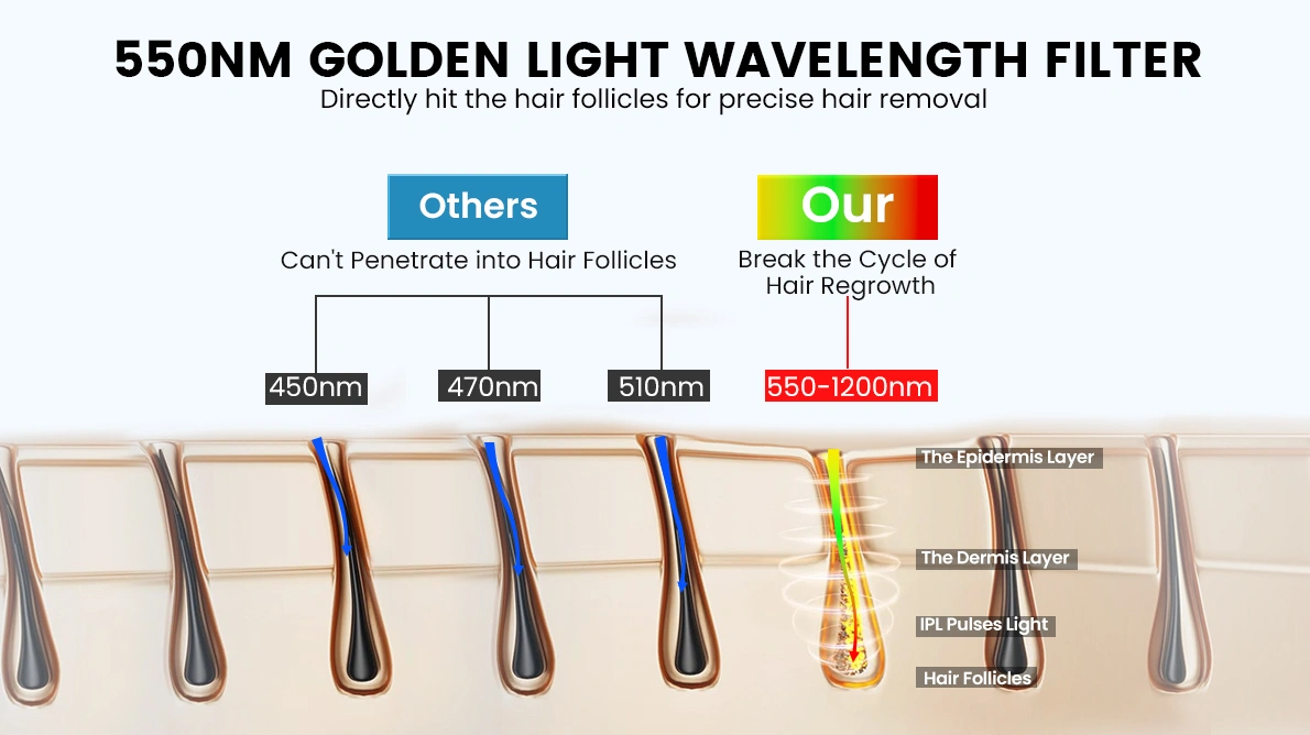 Wochuan IPl hair removal