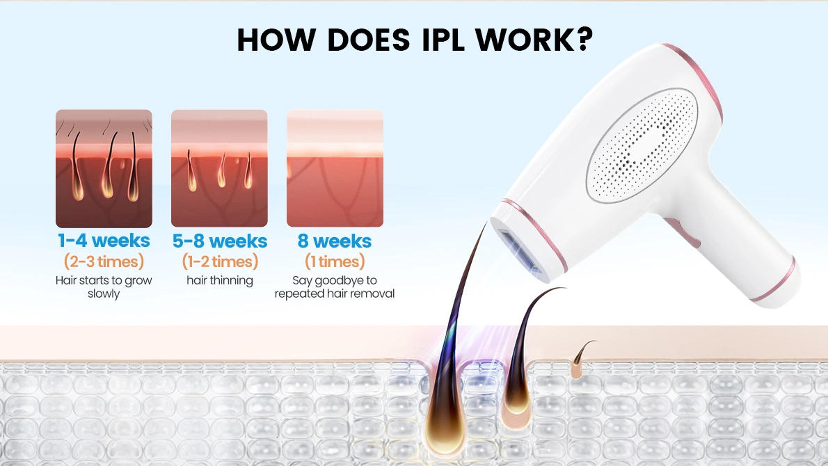 HOW DOES IPL WORK?