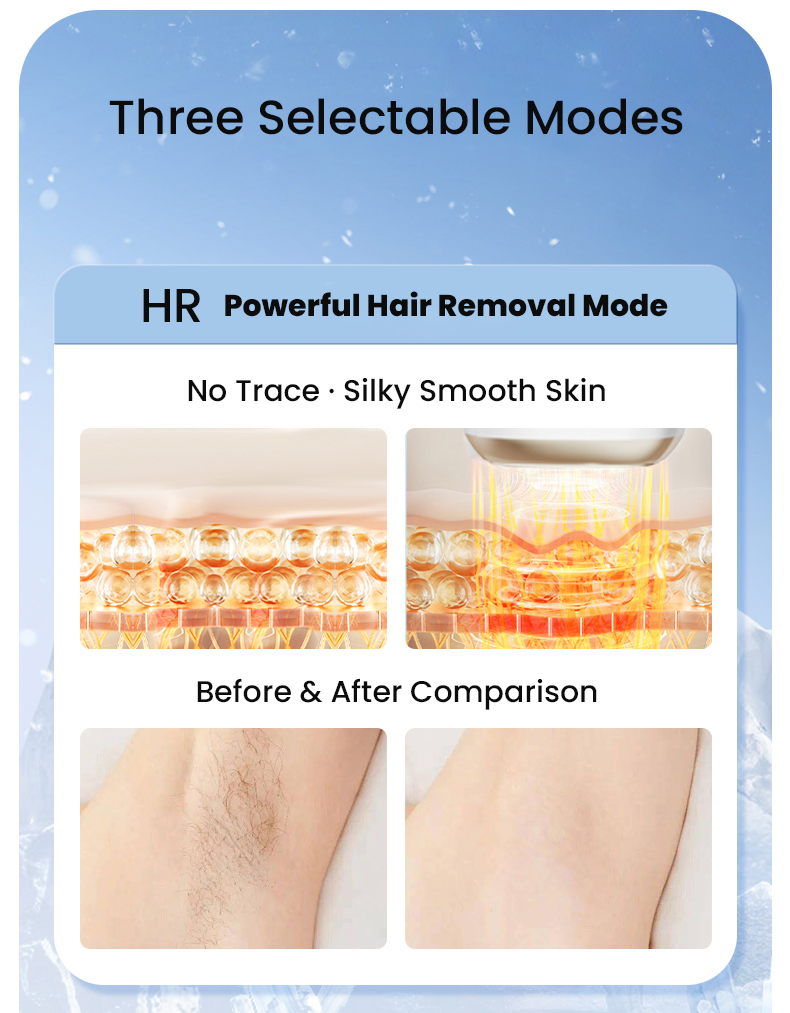 3 Modos: Depilação, Skin Care, Acne Care