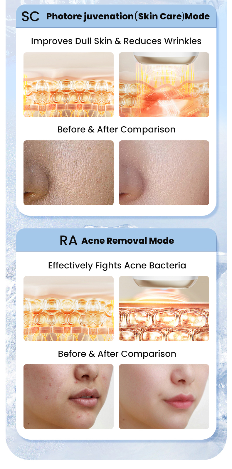 3 Modos: Depilação, Skin Care, Acne Care